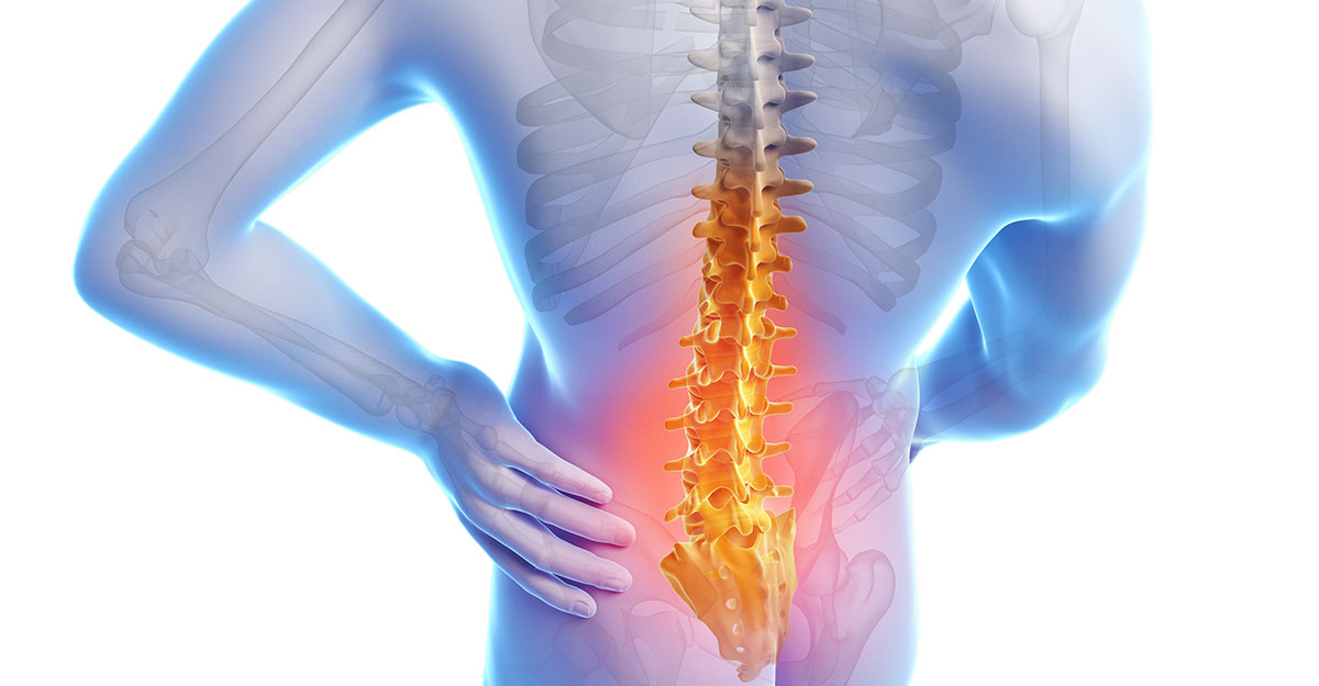 Featured image for Jacksonville and Fleming Island Back Pain Treatment