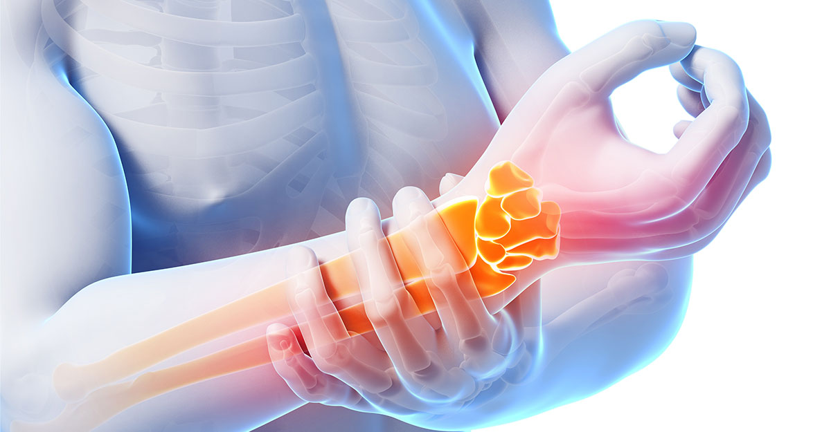 Featured image for Chiropractic Helps Carpal Tunnel Syndrome