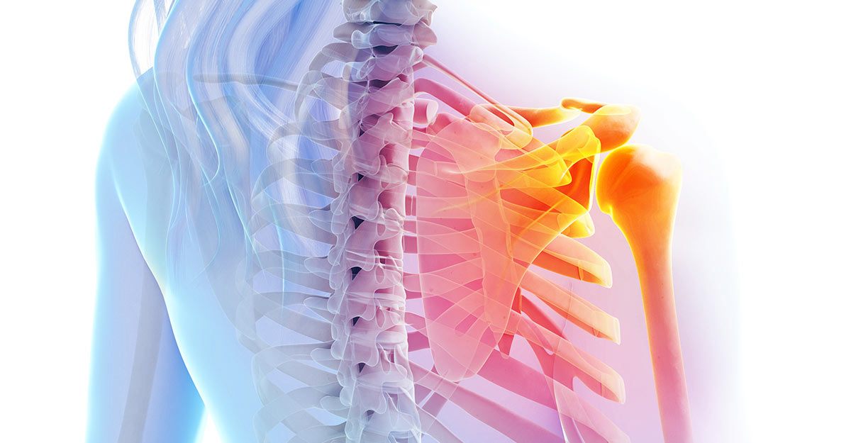 Jacksonville and Fleming Island, FL shoulder pain treatment and recovery